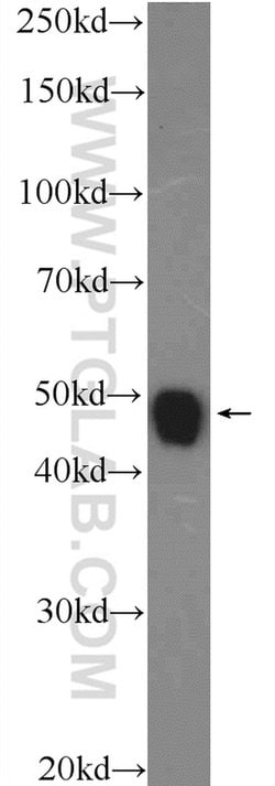 NPTX2 Rabbit anti-Human, Mouse, Rat, Polyclonal, Proteintech 150 &mu;L;