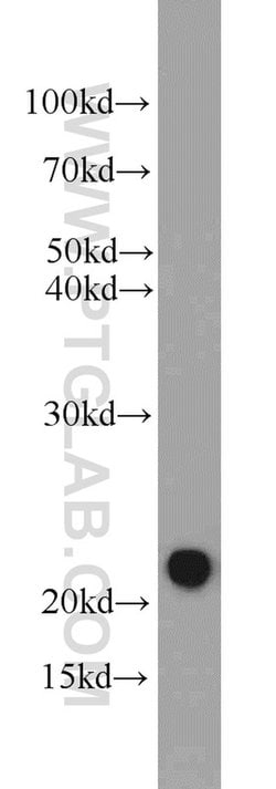 CSRP2 Rabbit anti-Human, Mouse, Rat, Polyclonal, Proteintech 20 &mu;L; Unconjugated 