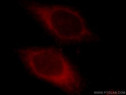 CYB5R3 Rabbit anti-Human, Mouse, Porcine, Rat, Polyclonal, Proteintech:Antibodies:Primary