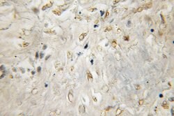 CYB5R3 Rabbit anti-Human, Mouse, Porcine, Rat, Polyclonal, Proteintech:Antibodies:Primary