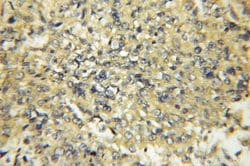 CYB5R3 Rabbit anti-Human, Mouse, Porcine, Rat, Polyclonal, Proteintech:Antibodies:Primary