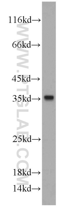 CYB5R3 Rabbit anti-Human, Mouse, Porcine, Rat, Polyclonal, Proteintech:Antibodies:Primary