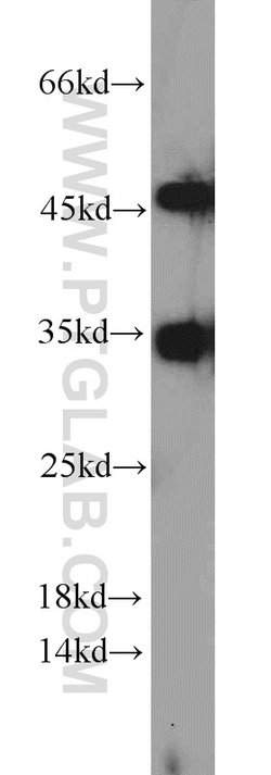 CYB5R3 Rabbit anti-Human, Mouse, Porcine, Rat, Polyclonal, Proteintech:Antibodies:Primary