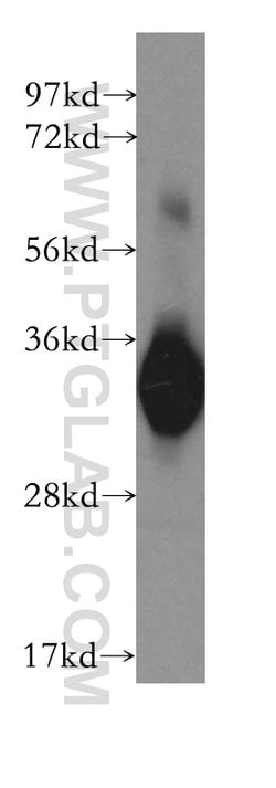 CYB5R3 Rabbit anti-Human, Mouse, Porcine, Rat, Polyclonal, Proteintech:Antibodies:Primary