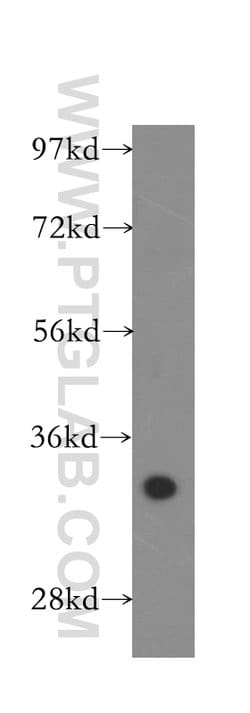 CYB5R3 Rabbit anti-Human, Mouse, Porcine, Rat, Polyclonal, Proteintech:Antibodies:Primary