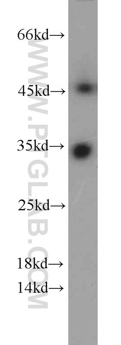 CYB5R3 Rabbit anti-Human, Mouse, Porcine, Rat, Polyclonal, Proteintech:Antibodies:Primary
