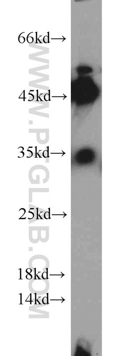 CYB5R3 Rabbit anti-Human, Mouse, Porcine, Rat, Polyclonal, Proteintech:Antibodies:Primary