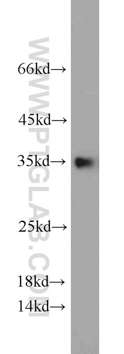 CYB5R3 Rabbit anti-Human, Mouse, Porcine, Rat, Polyclonal, Proteintech:Antibodies:Primary