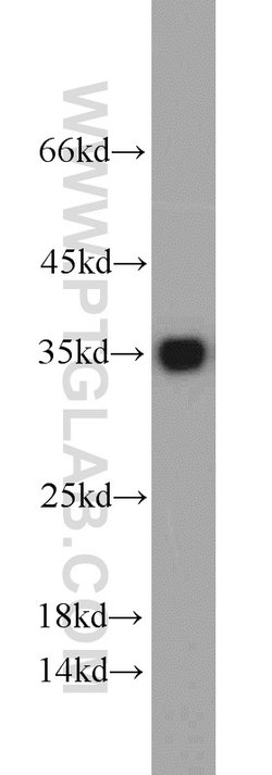 CYB5R3 Rabbit anti-Human, Mouse, Porcine, Rat, Polyclonal, Proteintech:Antibodies:Primary