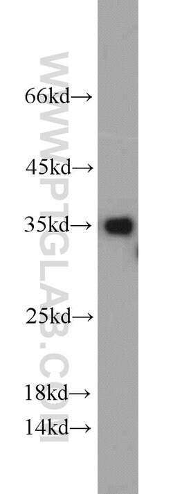 CYB5R3 Rabbit anti-Human, Mouse, Porcine, Rat, Polyclonal, Proteintech:Antibodies:Primary