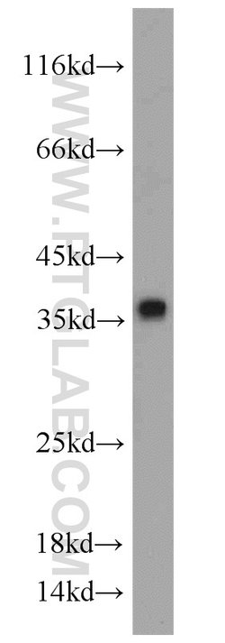 CYB5R3 Rabbit anti-Human, Mouse, Porcine, Rat, Polyclonal, Proteintech:Antibodies:Primary