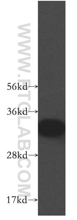 CYB5R3 Rabbit anti-Human, Mouse, Porcine, Rat, Polyclonal, Proteintech:Antibodies:Primary