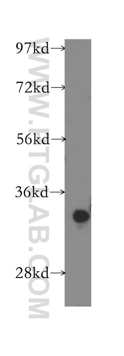 CYB5R3 Rabbit anti-Human, Mouse, Porcine, Rat, Polyclonal, Proteintech:Antibodies:Primary