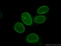 LMNB2 Rabbit anti-Human, Mouse, Rat, Polyclonal, Proteintech:Antibodies:Primary