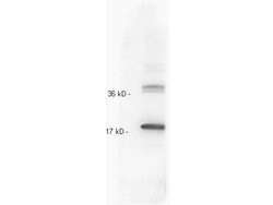 IL-10 Polyclonal Antibody, Rockland 1 mL; Unconjugated:Antibodies, Polyclonal