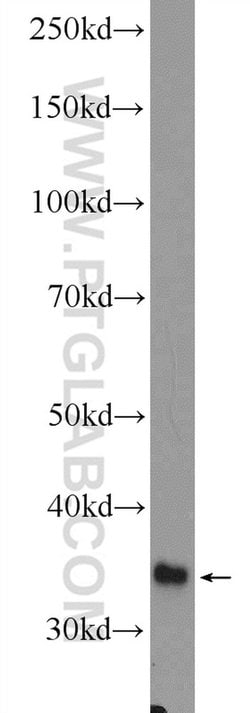 GLYAT Rabbit anti-Human, Mouse, Polyclonal, Proteintech:Antibodies:Primary