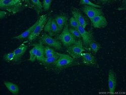 VPS18 Rabbit anti-Human, Mouse, Rat, Polyclonal, Proteintech:Antibodies:Primary