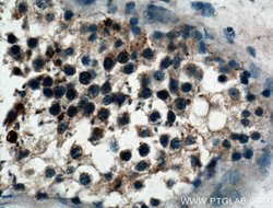 VPS18 Rabbit anti-Human, Mouse, Rat, Polyclonal, Proteintech:Antibodies:Primary
