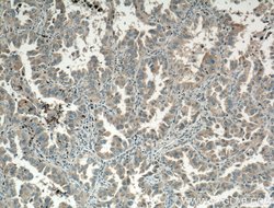 VPS18 Rabbit anti-Human, Mouse, Rat, Polyclonal, Proteintech:Antibodies:Primary