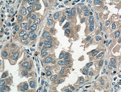 VPS18 Rabbit anti-Human, Mouse, Rat, Polyclonal, Proteintech:Antibodies:Primary