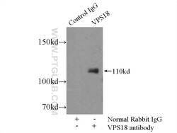 VPS18 Rabbit anti-Human, Mouse, Rat, Polyclonal, Proteintech:Antibodies:Primary