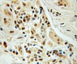 NUDT11 Rabbit anti-Human, Mouse, Polyclonal, Proteintech:Antibodies:Primary