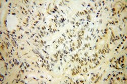 NUDT11 Rabbit anti-Human, Mouse, Polyclonal, Proteintech:Antibodies:Primary