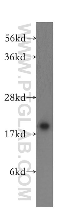 NUDT11 Rabbit anti-Human, Mouse, Polyclonal, Proteintech:Antibodies:Primary