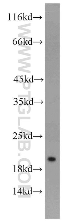 NUDT11 Rabbit anti-Human, Mouse, Polyclonal, Proteintech:Antibodies:Primary