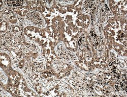 MYL3 Rabbit anti-Human, Mouse, Rat, Polyclonal, Proteintech 150 &mu;L;