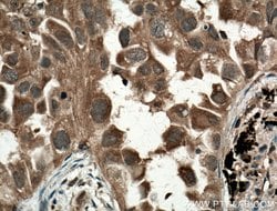 MYL3 Rabbit anti-Human, Mouse, Rat, Polyclonal, Proteintech 150 &mu;L;