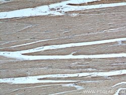 MYL3 Rabbit anti-Human, Mouse, Rat, Polyclonal, Proteintech 150 &mu;L;