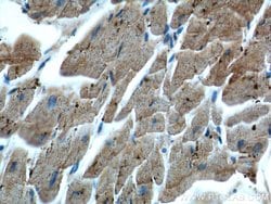 MYL3 Rabbit anti-Human, Mouse, Rat, Polyclonal, Proteintech 150 &mu;L;