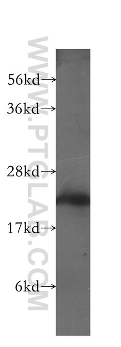 MYL3 Rabbit anti-Human, Mouse, Rat, Polyclonal, Proteintech 150 &mu;L;