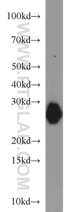 MYL3 Rabbit anti-Human, Mouse, Rat, Polyclonal, Proteintech 150 &mu;L;