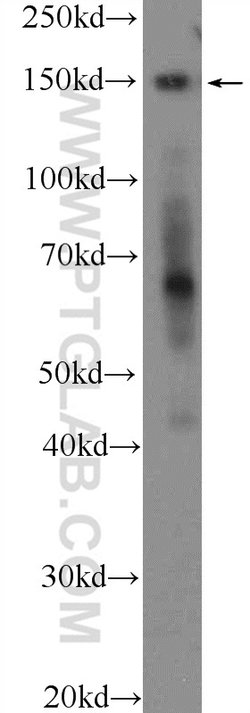 CTCF Rabbit anti-Human, Mouse, Rat, Polyclonal, Proteintech:Antibodies:Primary