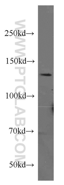 CTCF Rabbit anti-Human, Mouse, Rat, Polyclonal, Proteintech:Antibodies:Primary