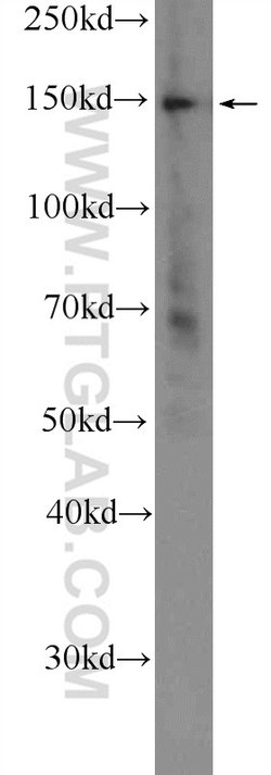 CTCF Rabbit anti-Human, Mouse, Rat, Polyclonal, Proteintech:Antibodies:Primary