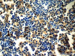 GATA1 Rabbit anti-Human, Mouse, Rat, Polyclonal, Proteintech 150 &mu;L | Buy Online | Proteintech Group Inc | Fisher Scientific