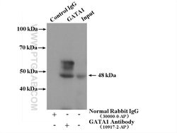GATA1 Rabbit anti-Human, Mouse, Rat, Polyclonal, Proteintech 150 &mu;L | Buy Online | Proteintech Group Inc | Fisher Scientific