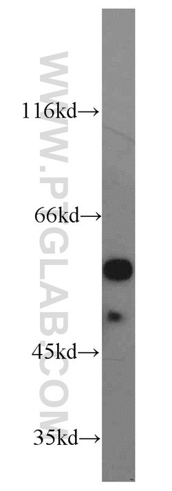 GATA1 Rabbit anti-Human, Mouse, Rat, Polyclonal, Proteintech 150 &mu;L | Buy Online | Proteintech Group Inc | Fisher Scientific