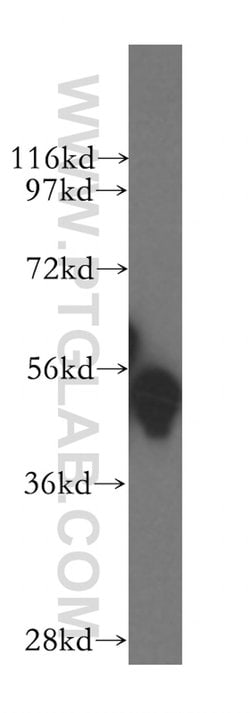 GATA1 Rabbit anti-Human, Mouse, Rat, Polyclonal, Proteintech 150 &mu;L | Buy Online | Proteintech Group Inc | Fisher Scientific