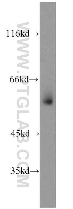 GATA1 Rabbit anti-Human, Mouse, Rat, Polyclonal, Proteintech 150 &mu;L | Buy Online | Proteintech Group Inc | Fisher Scientific