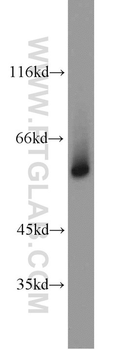 GATA1 Rabbit anti-Human, Mouse, Rat, Polyclonal, Proteintech 150 &mu;L | Buy Online | Proteintech Group Inc | Fisher Scientific