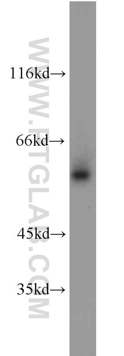 GATA1 Rabbit anti-Human, Mouse, Rat, Polyclonal, Proteintech 150 &mu;L | Buy Online | Proteintech Group Inc | Fisher Scientific