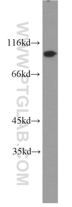 CDC27/APC3 Rabbit anti-Human, Mouse, Rat, Polyclonal, Proteintech 150 &mu;L;