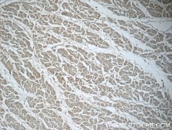 Renin receptor/ATP6AP2 Rabbit anti-Human, Mouse, Rat, Polyclonal, Proteintech:Antibodies:Primary