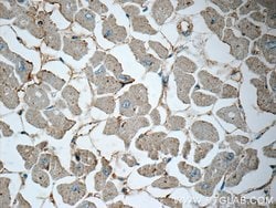 Renin receptor/ATP6AP2 Rabbit anti-Human, Mouse, Rat, Polyclonal, Proteintech:Antibodies:Primary