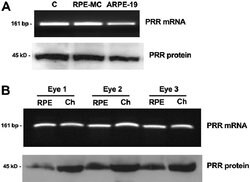 Renin receptor/ATP6AP2 Rabbit anti-Human, Mouse, Rat, Polyclonal, Proteintech:Antibodies:Primary