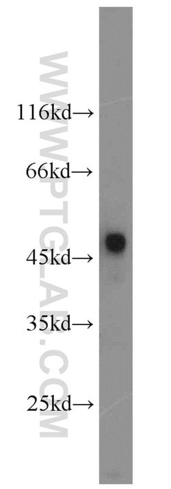 Renin receptor/ATP6AP2 Rabbit anti-Human, Mouse, Rat, Polyclonal, Proteintech:Antibodies:Primary